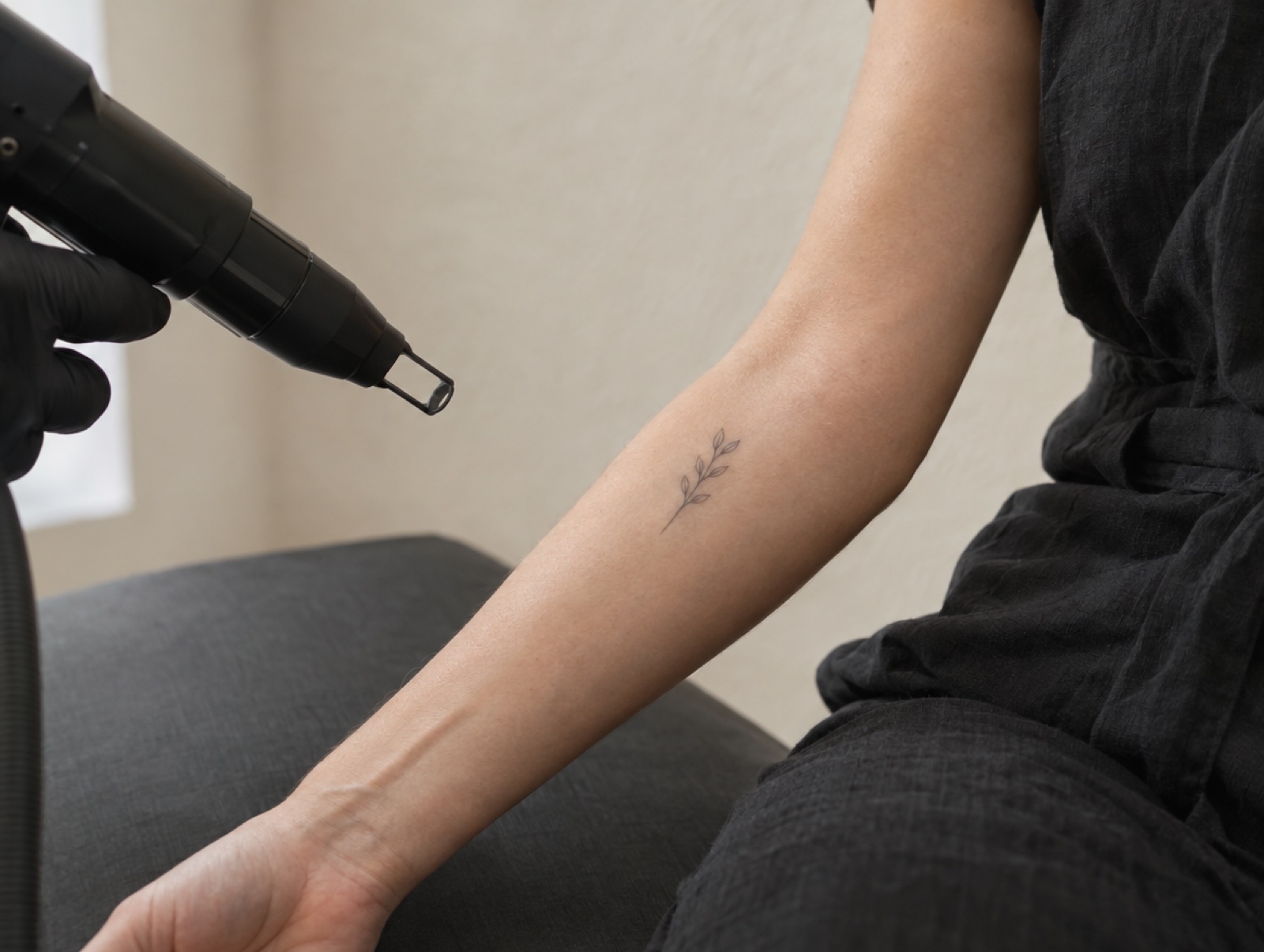 Eliminación de tatuajes
